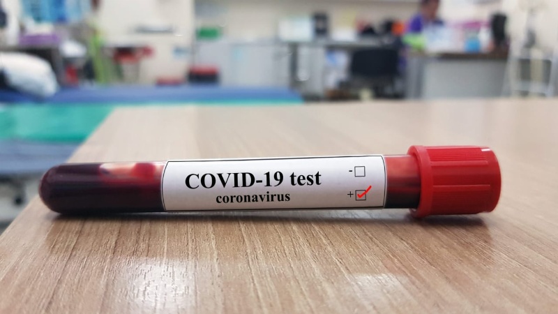 Roldán sumó un nuevo caso positivo de coronavirus
